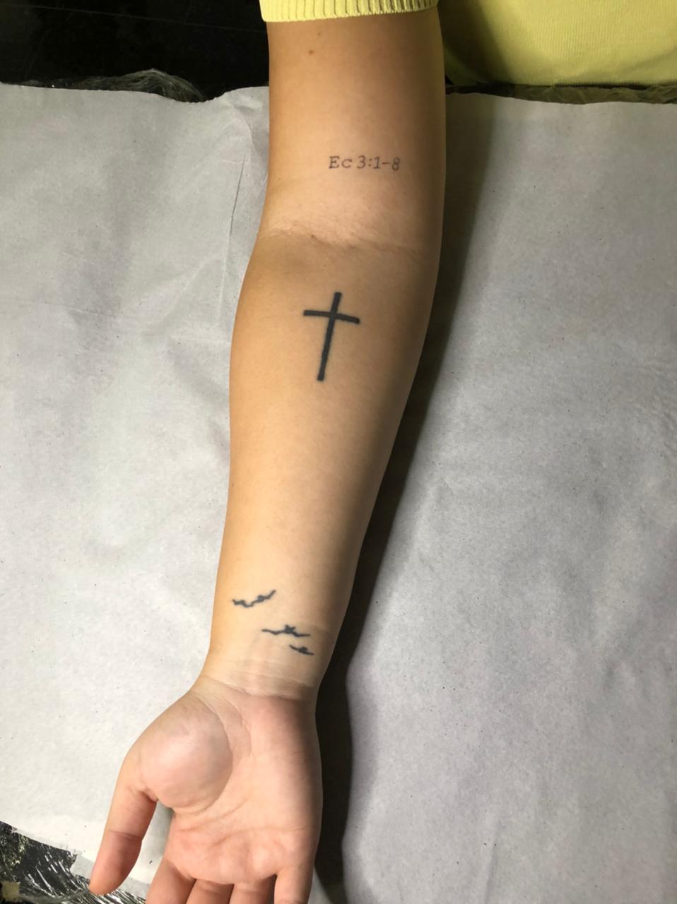 De remoção à cobertura, tatuagens podem ser revertidas