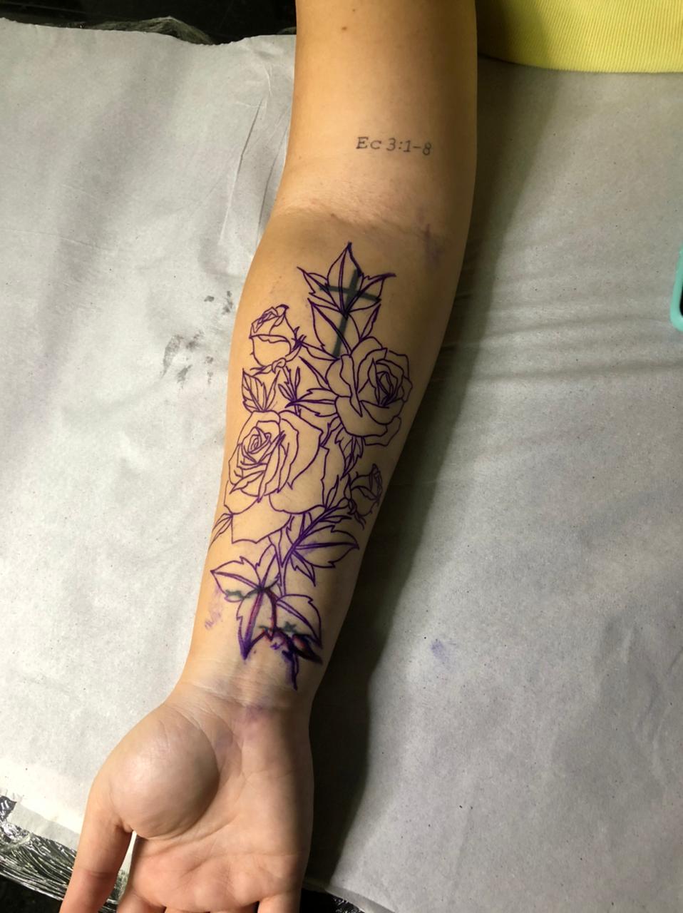 De remoção à cobertura, tatuagens podem ser revertidas