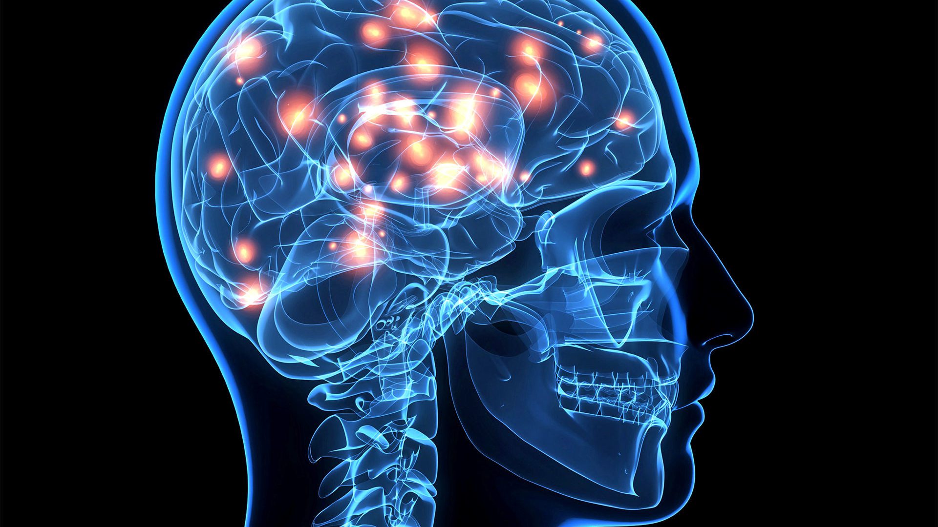 Doença rara e degenerativa: neurologista explica os sintomas da Doença de Creutzfeldt-Jakob - QTU Questões do Universo