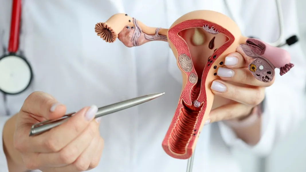 utero cancer