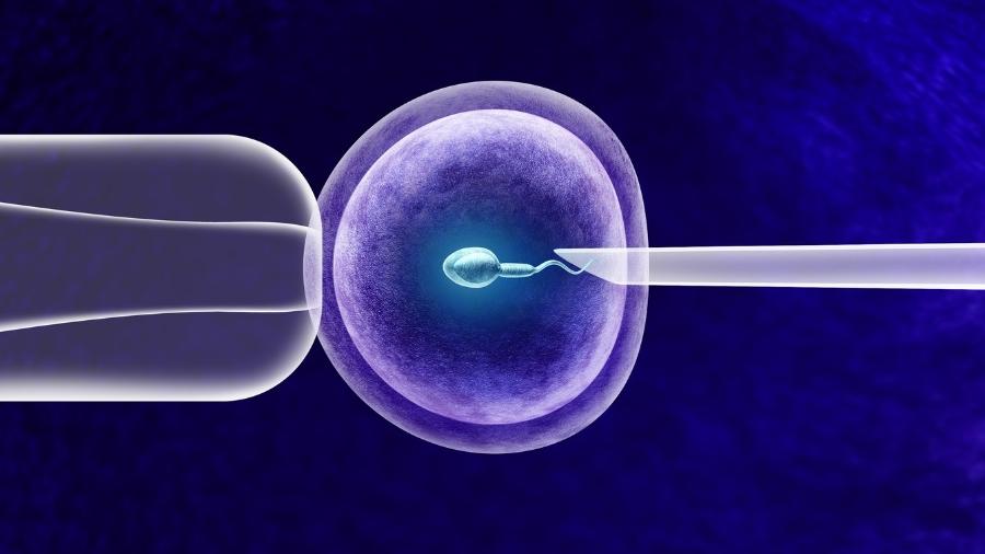 IA pode reduzir tempo e tentativas frustradas em tratamentos de fertilização in vitro