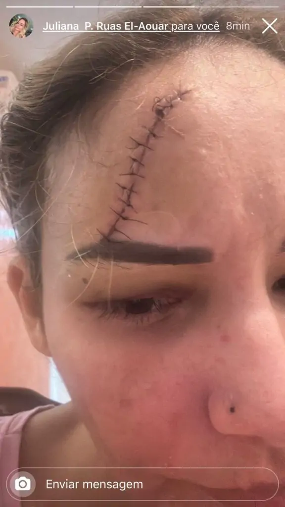 Foto de médica com corte na testa pode provar constantes agressões do ex-prefeito de Minas