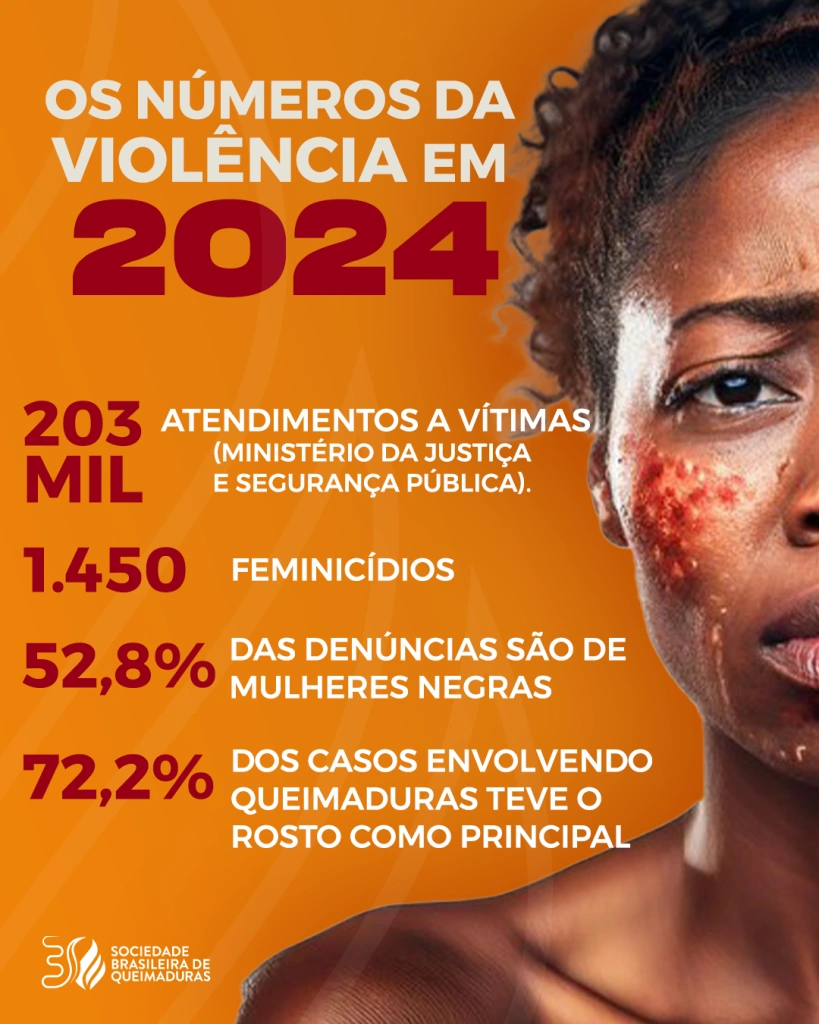 Junho Laranja: Sociedade Brasileira de Queimaduras coloca a violência doméstica em pauta