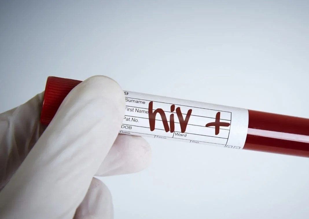 TESTE HIV
