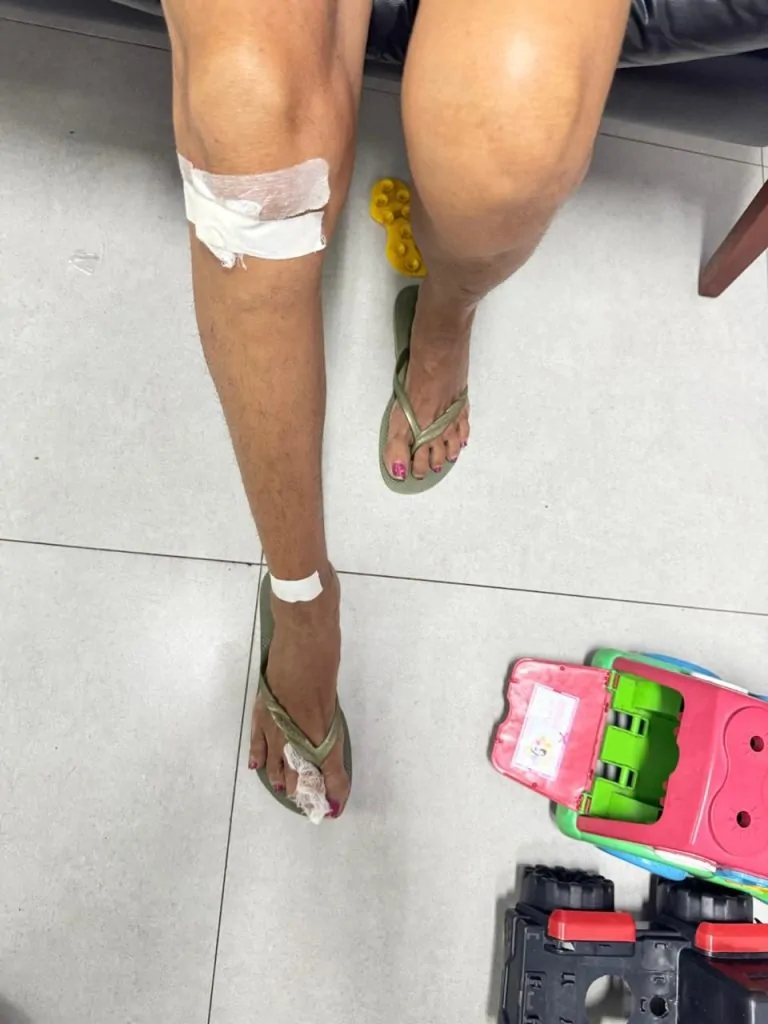 Filho é detido após agredir mãe com socos e mordidas em Vila Velha