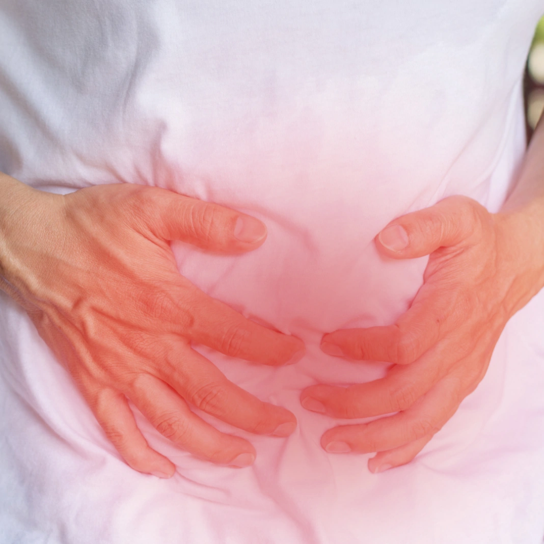 Doença de Crohn