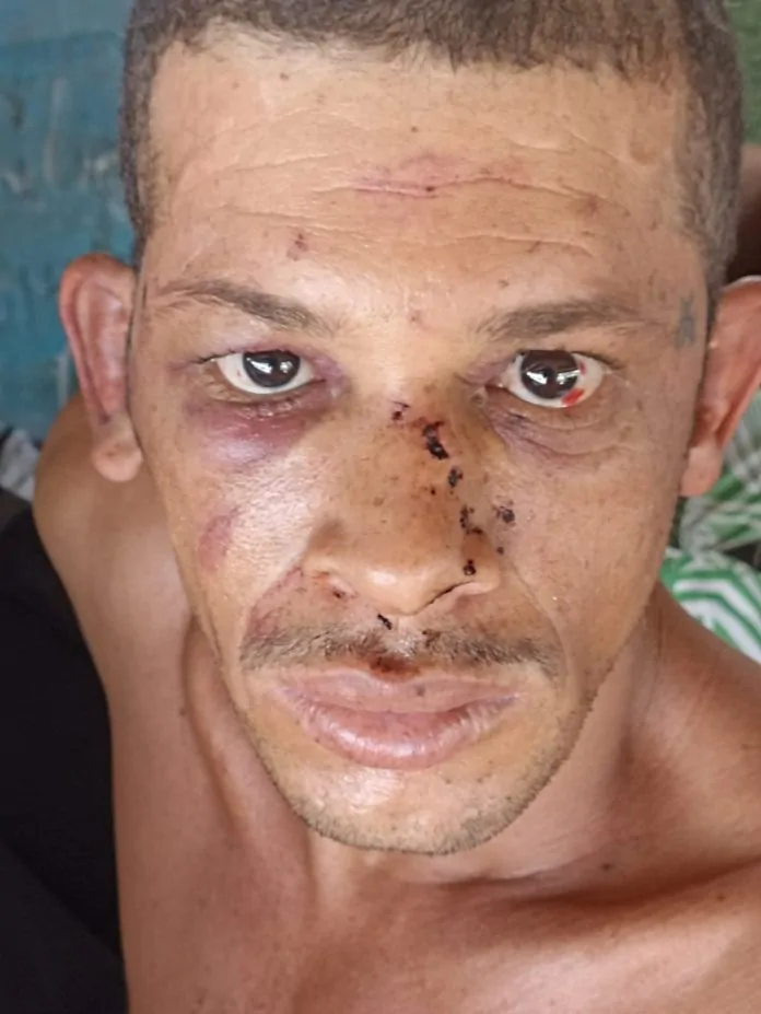 “Limpeza social”: nove réus vão a júri por tortura e morte de morador de rua no ES